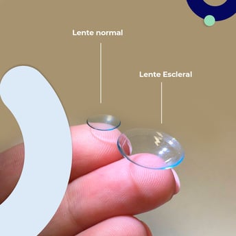 lentes-contacto-operacion